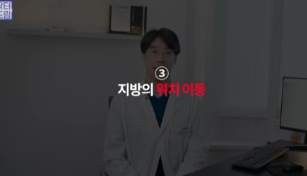 눈밑지방 없애러 왔는데 지방이식을 하라구요? 사진 28