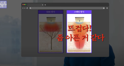 안아프고 하자마자 이뻐지는 티타늄레이저, 나만 아픈 이유? 작용원리 알아보기 사진 22