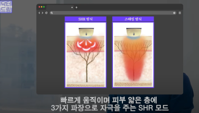 안아프고 하자마자 이뻐지는 티타늄레이저, 나만 아픈 이유? 작용원리 알아보기 사진 19