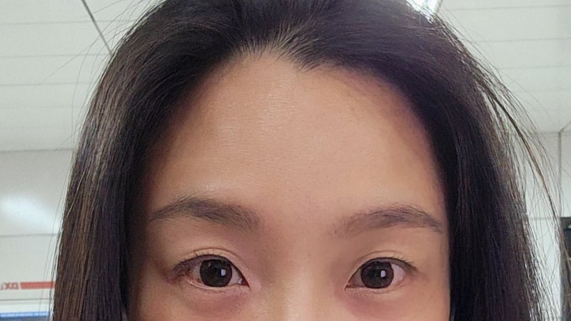 역삼동성형외과 방문을 고민하시는 분께 드리는 편지 -장준철 대표원장 진료철학