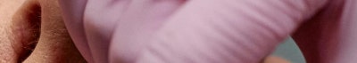 신논현 성형외과 팔자주름 실리프팅? 실패하지 않으려면 이것만 보고 가세요. 사진 24