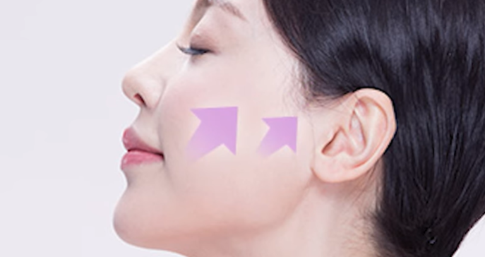 강남 실리프팅vs레이저? 효과로만 따져서는 안되는 이유 사진 2