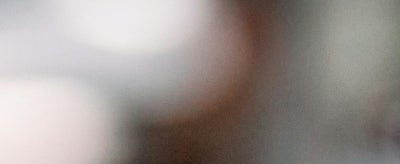 강남안면거상, 먼저 권유드리지 않는 이유? 솔직히 밝힙니다. 사진 15