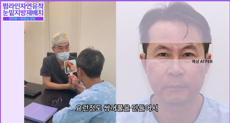 강남 남자눈성형, 자연스럽게 잘하는 병원을 찾고 계신다면 사진 8