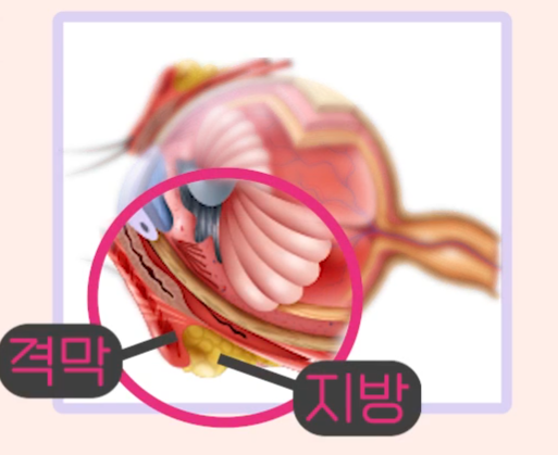강남 하안검, 대표 원장이 가장 자주 듣는 질문 5가지 사진 3