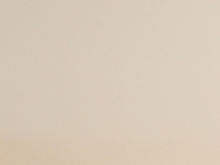텐써마 시술로 눈가 주름 고민 해결하기 사진 15