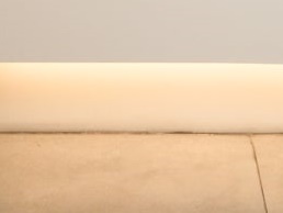 상안검수술 장점부터 주의해야 할 부분까지 알아봅시다 사진 25