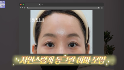 요즘 쌍꺼풀 안하는 상상초월 이유/ 쌍꺼풀 대신 이거합니다 사진 31