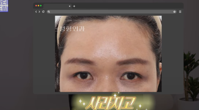 요즘 쌍꺼풀 안하는 상상초월 이유/ 쌍꺼풀 대신 이거합니다 사진 29