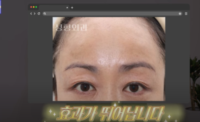 요즘 쌍꺼풀 안하는 상상초월 이유/ 쌍꺼풀 대신 이거합니다 사진 15