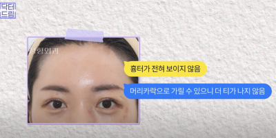 요즘 쌍꺼풀 안하는 상상초월 이유/ 쌍꺼풀 대신 이거합니다 사진 8