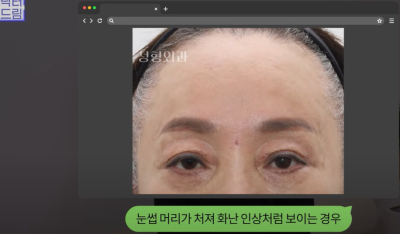 요즘 쌍꺼풀 안하는 상상초월 이유/ 쌍꺼풀 대신 이거합니다 사진 17