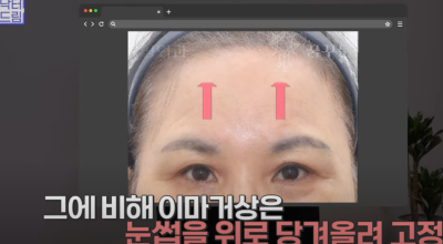 요즘 쌍꺼풀 안하는 상상초월 이유/ 쌍꺼풀 대신 이거합니다 사진 24