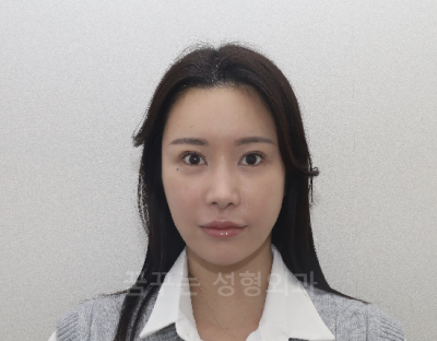 강남 이마거상 8일차 후기, 일본 모델 아야의 고민– 2-30대 이마주름 사진 5