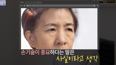 레이저 아플수록 효과가 좋을까요? 사진 10