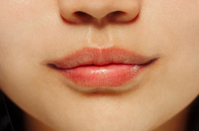 강남역 입술필러 장인을 찾는다면? = 꿈꾸는 성형외과! 💋✨ 사진 13