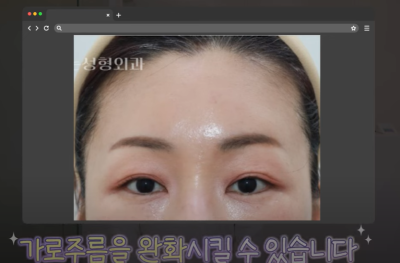 이마거상 좋은건 알겠는데 너무 무서워요 사진 23