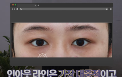 [연예인쌍꺼풀 공식] 나에게 어울리는 쌍꺼풀 찾기 사진 19