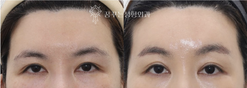 강남 중년 안티에이징, 우아하게 나이들고 싶다면 사진 14