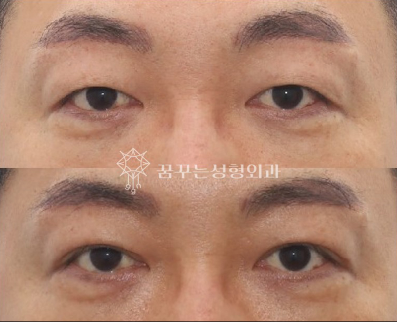 강남 중년 안티에이징, 우아하게 나이들고 싶다면 사진 11