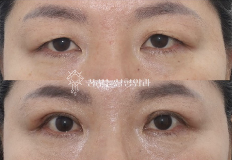 강남 중년 안티에이징, 우아하게 나이들고 싶다면 사진 10