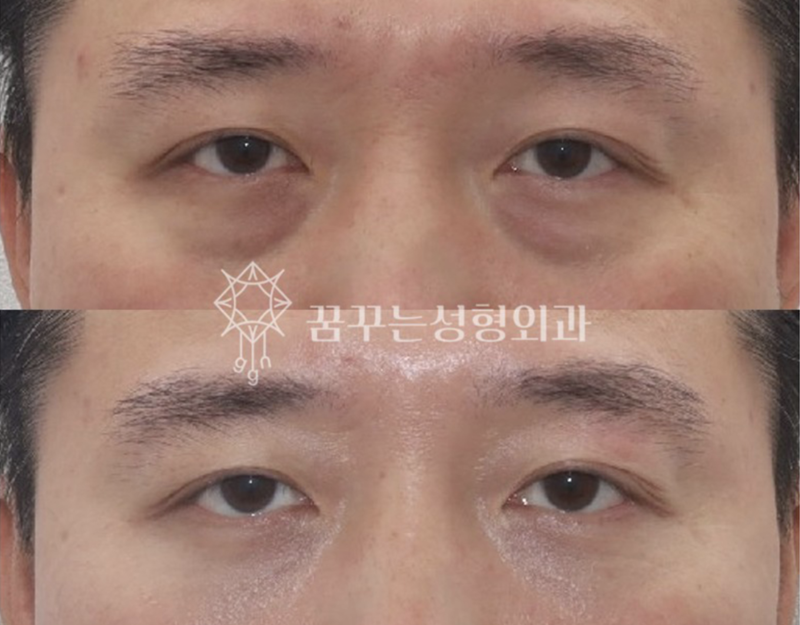강남 중년 안티에이징, 우아하게 나이들고 싶다면 사진 16