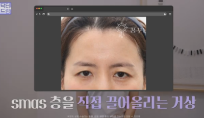 여름에도 모공없는 매끈도자기피부 만드는 방법 사진 13