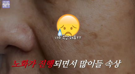 여름에도 모공없는 매끈도자기피부 만드는 방법 사진 2