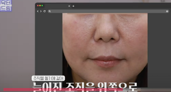여름에도 모공없는 매끈도자기피부 만드는 방법 사진 15