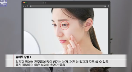 필러로 석사딴 원장이 깨달은 '진짜' 콜라겐부스터 사진 13