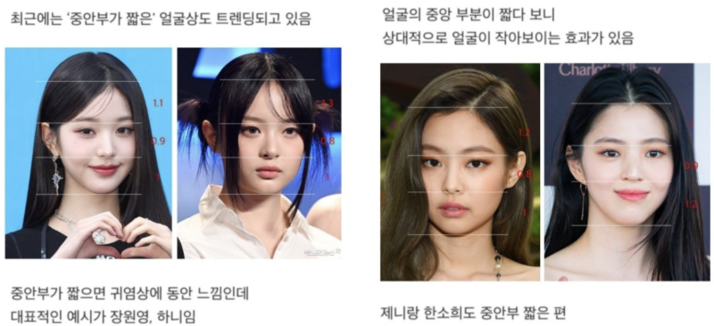 강남 실리프팅으로 짧은 중안면 만들기! 요즘 동안 성형의 핵심💡