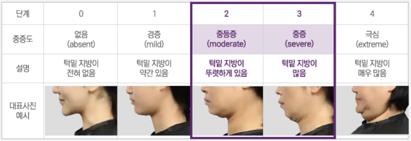 강남역 브이올렛 후기,이중턱 고민 깔끔하게 해결. 사진 3