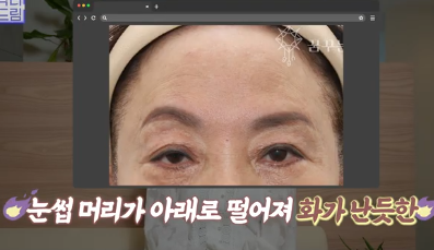 이마거상받고 3년지났는데...이거 어떡하죠? 원장아내가 받은 이마거상 후기 사진 18