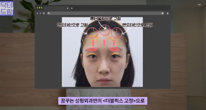 이마거상받고 3년지났는데...이거 어떡하죠? 원장아내가 받은 이마거상 후기 사진 8