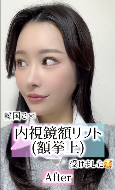 강남역 이마거상 잘하는 병원? 챗GPT에게 물어봤다 사진 9