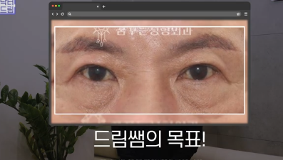 우리아빠 10살 어려보이는 중년남성 눈성형의 모든 것 사진 12