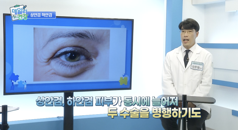강남역 중년성형, 상안검·하안검 전문“20년은 젊어져요!” 눈성형 전문 성형외과 추천 사진 3