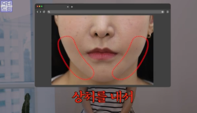 콜라겐 한 달 안먹으니 이렇게 됐습니다 .콜라겐 진짜 효과 있나요? 사진 20