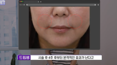 콜라겐 한 달 안먹으니 이렇게 됐습니다 .콜라겐 진짜 효과 있나요? 사진 22