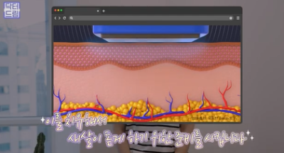 콜라겐 한 달 안먹으니 이렇게 됐습니다 .콜라겐 진짜 효과 있나요? 사진 17