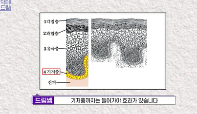 콜라겐 한 달 안먹으니 이렇게 됐습니다 .콜라겐 진짜 효과 있나요? 사진 11
