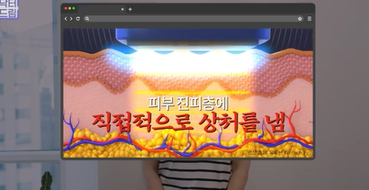 콜라겐 한 달 안먹으니 이렇게 됐습니다 .콜라겐 진짜 효과 있나요? 사진 15