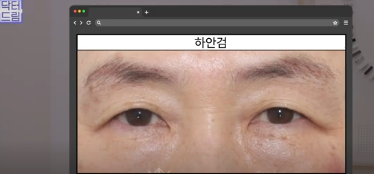 평생 딱 한번만 할 수 있는 수술 사진 14
