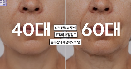평생 딱 한번만 할 수 있는 수술 사진 8