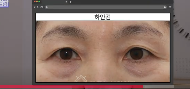 평생 딱 한번만 할 수 있는 수술 사진 12
