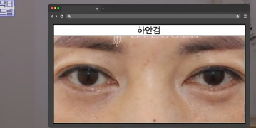 평생 딱 한번만 할 수 있는 수술 사진 17