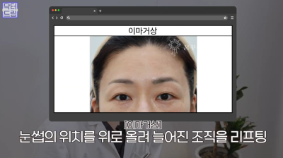 40대를 기준으로 얼굴에도 노후계획이 필요합니다 사진 19