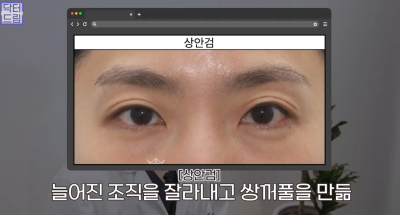 40대를 기준으로 얼굴에도 노후계획이 필요합니다 사진 13