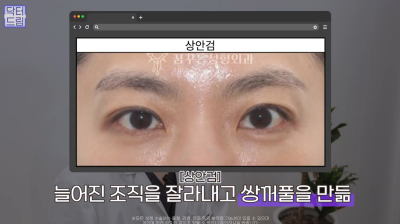 40대를 기준으로 얼굴에도 노후계획이 필요합니다 사진 14