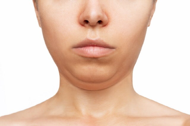 급하게 찐 살, 온다리프팅으로 얼굴 뿐만 아니라 바디라인까지 한번에 관리 사진 2